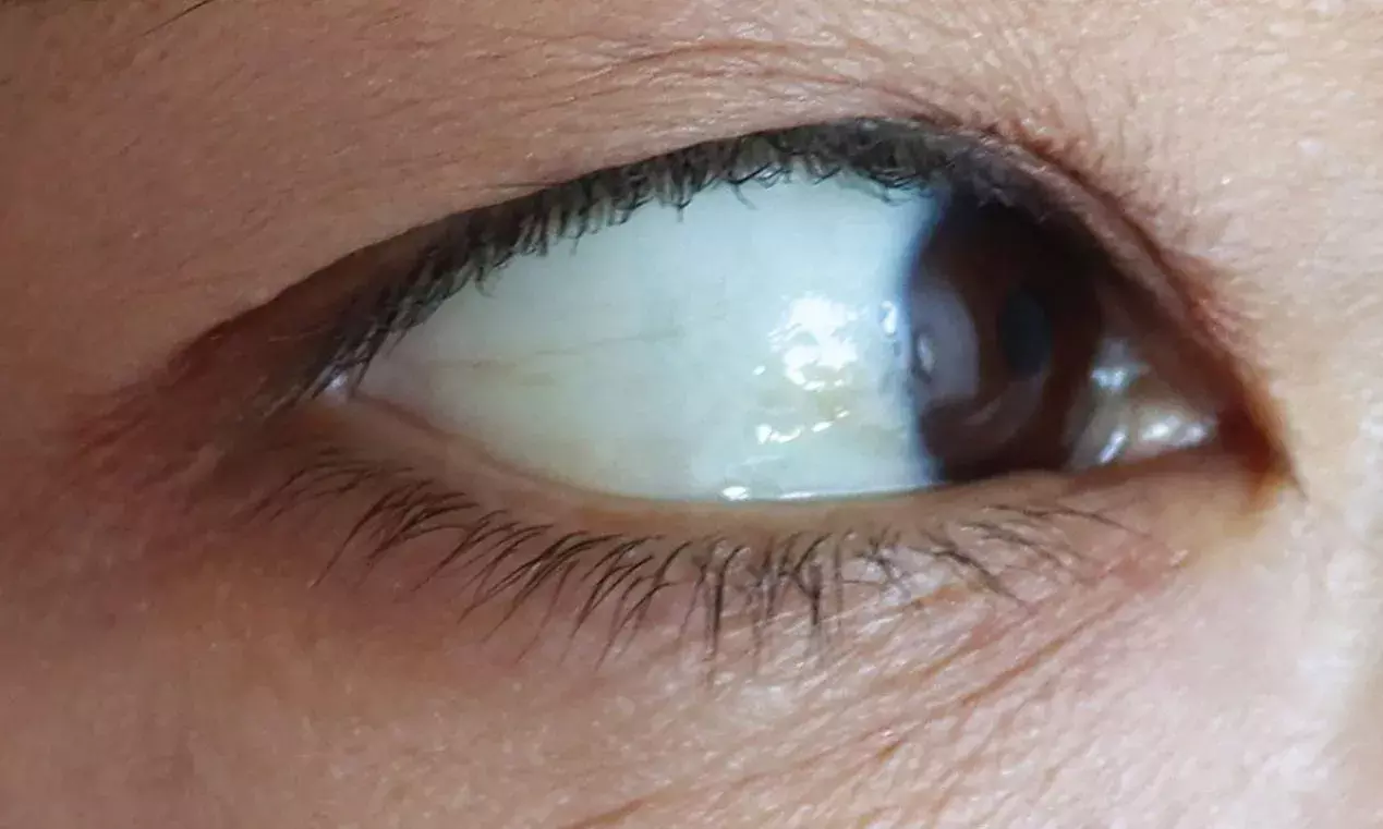 మహబూబాబాద్ లో వింత ఘటన