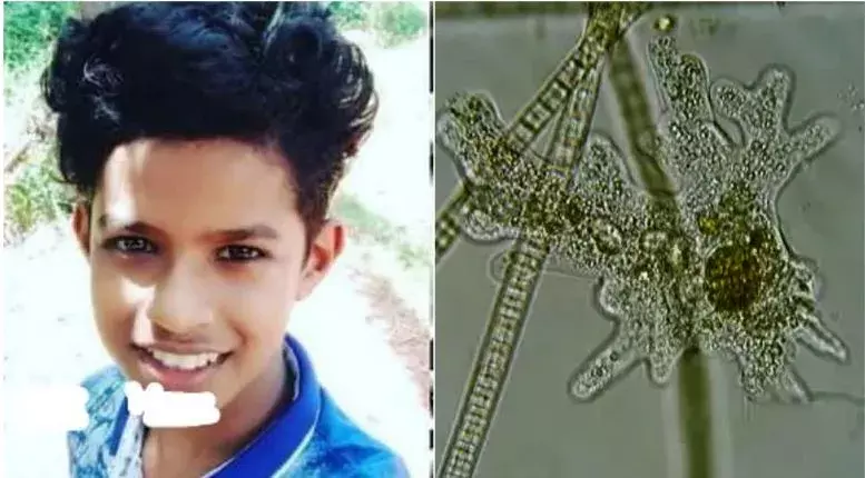 Brain-Eating Amoeba: అరుదైన వ్యాధితో కేరళ బాలుడి మృతి