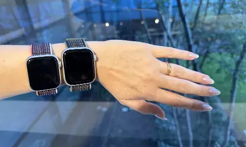 Apple-Amazon: ఆపిల్ వాచ్ ఆర్డర్ పెడితే, ఆమెకి వచ్చింది ఇదే..