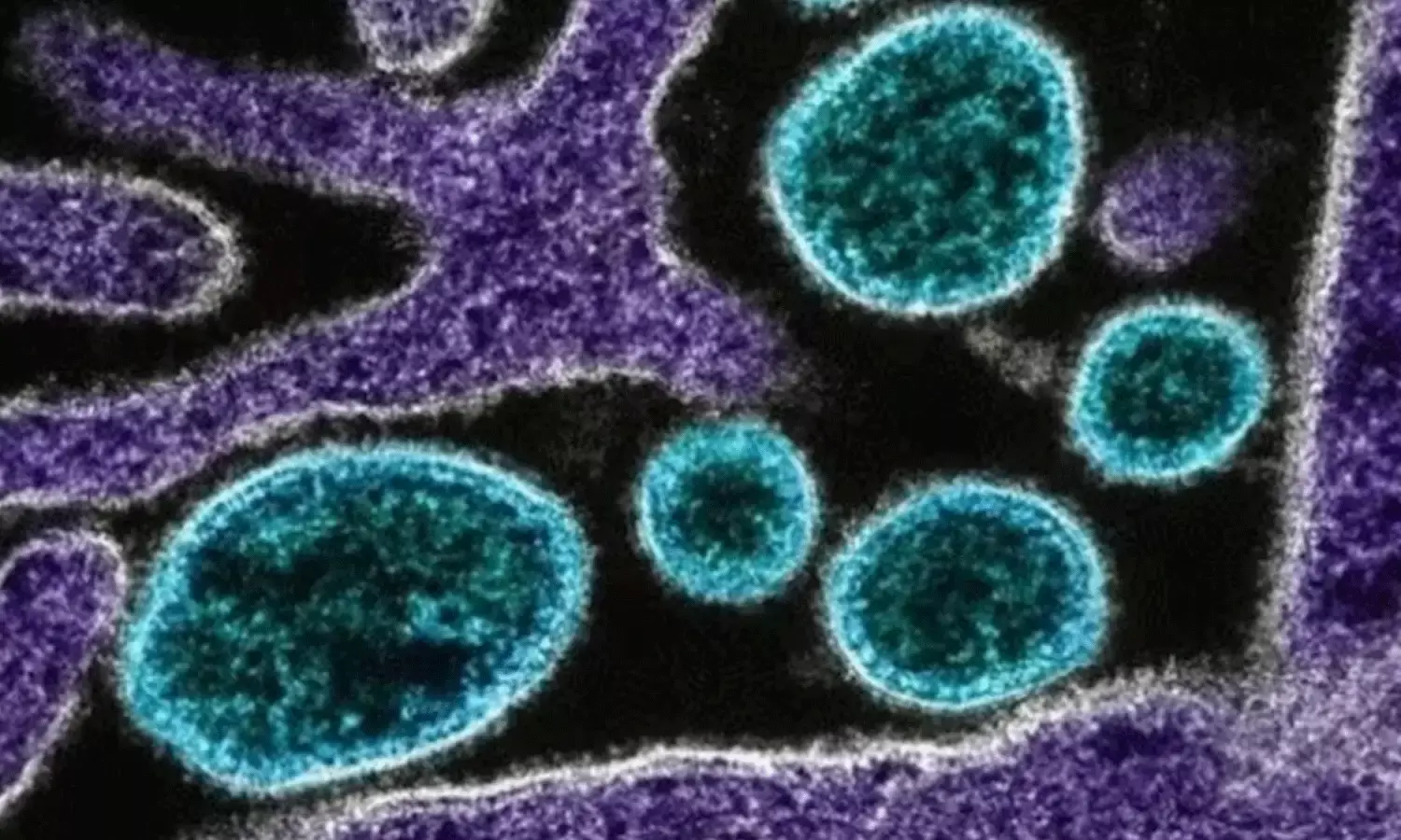 భయపెడుతున్న నిఫా.. బడులు మూత