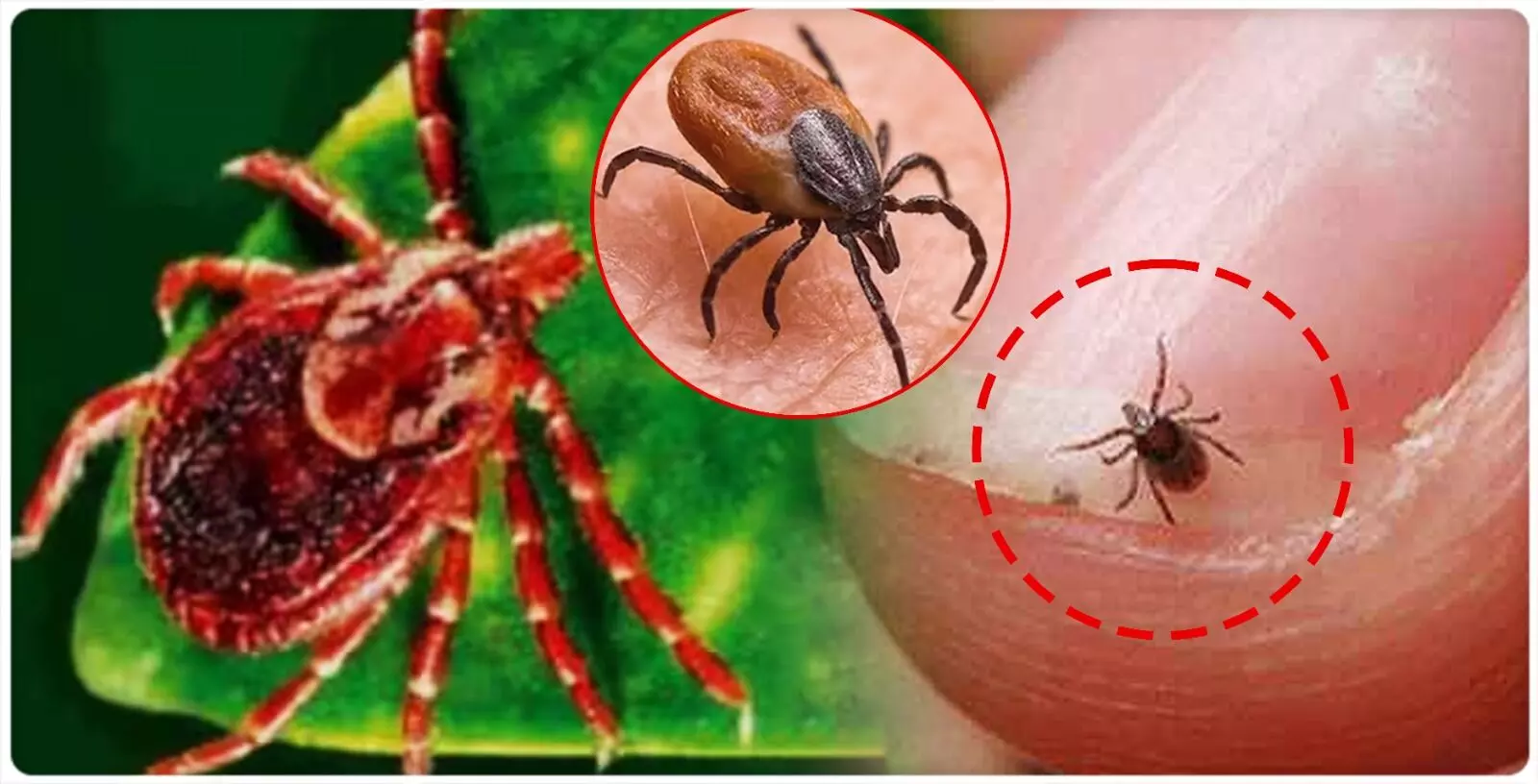 Scrub Typhus : భయపెడుతున్న స్క్రబ్ టైఫస్ Scrub Typhus : భయపెడుతున్న స్క్రబ్ టైఫస్