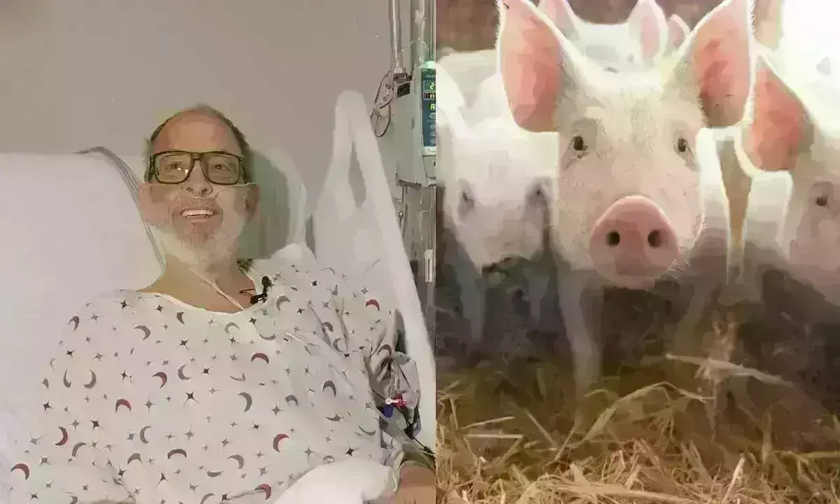 Heart Transplantation: మనిషికి పంది గుండె Heart Transplantation: మనిషికి పంది గుండె