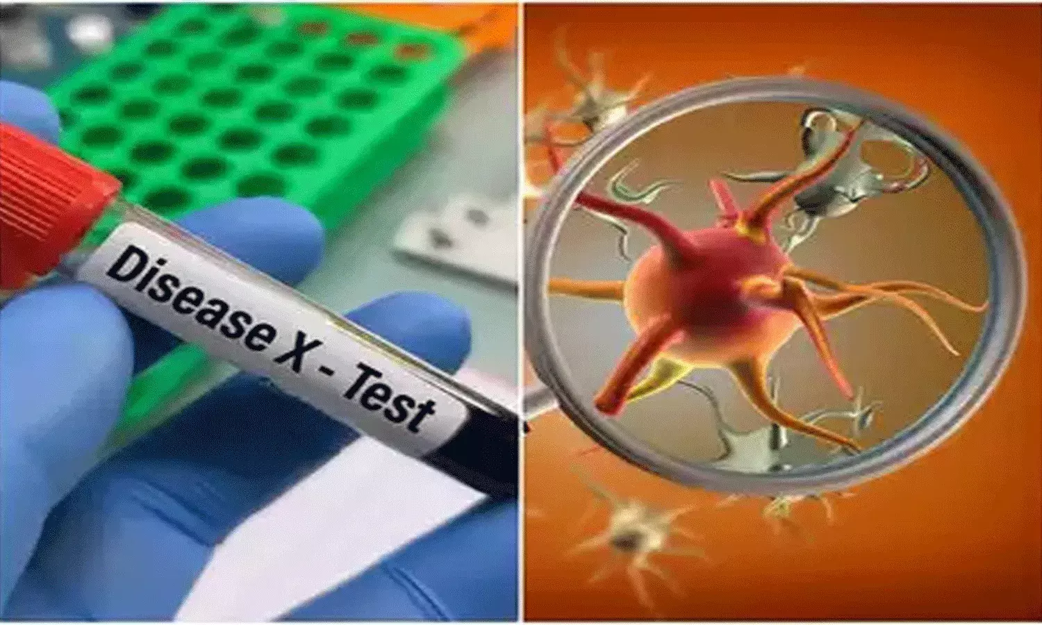 కొత్త వైరస్ డిసీజ్ X.. కరోనా కంటే 20 రెట్లు ప్రాణాంతకం