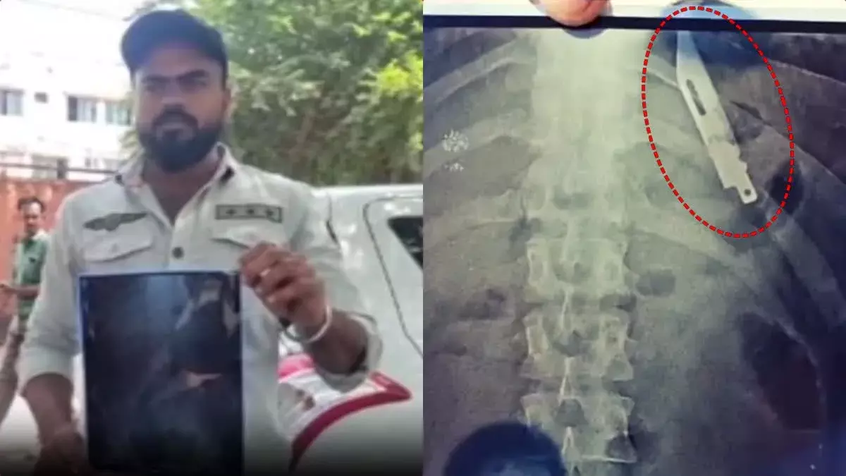 Knife In  Stomach : యువకుడి కడుపులో కత్తి.. ఐదేళ్లుగా నరకం