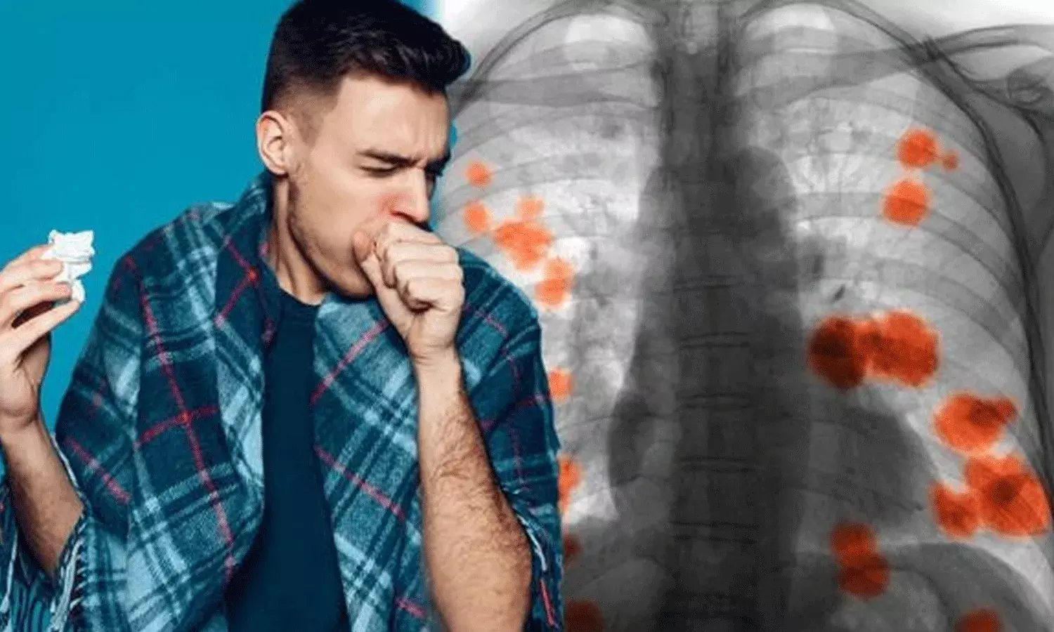 పురుషులలో ఊపిరితిత్తుల క్యాన్సర్.. ప్రారంభ సంకేతాలు పురుషులలో ఊపిరితిత్తుల క్యాన్సర్.. ప్రారంభ సంకేతాలు