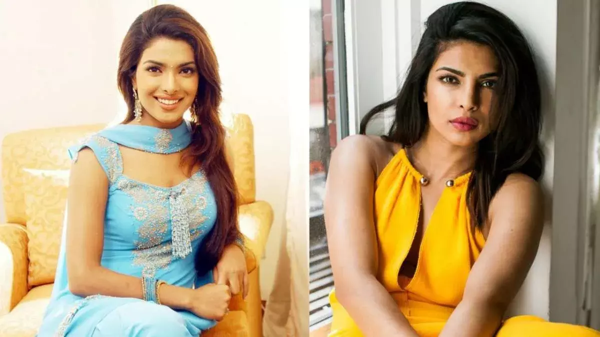 Nose Surgery Gone Wrong: ప్రియాంక కెరీర్ ను దెబ్బతీసిన ముక్కు సర్జరీ : ఆమె తల్లి మధు చోప్రా Nose Surgery Gone Wrong: ప్రియాంక కెరీర్ ను దెబ్బతీసిన ముక్కు సర్జరీ : ఆమె తల్లి మధు చోప్రా