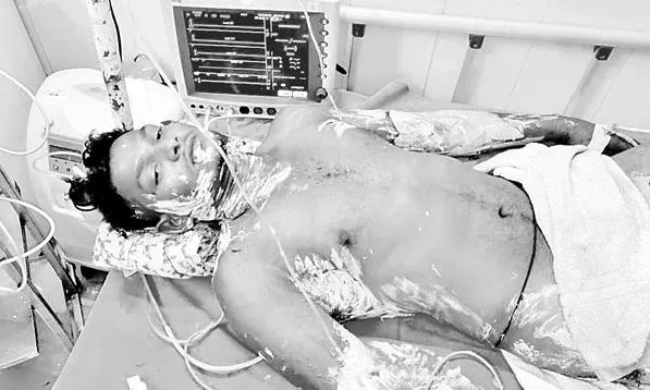 Ongole:  పోలీసుల దాష్టీకంతో దళిత యువకుడి ఆత్మహత్యా యత్నం Ongole:  పోలీసుల దాష్టీకంతో దళిత యువకుడి ఆత్మహత్యా యత్నం