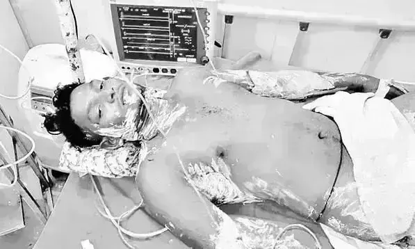 Ongole: పోలీసుల వేధింపులతో ఆత్మహత్యాయత్నం చేసిన ఎస్సీ యువకుడు మృతి Ongole: పోలీసుల వేధింపులతో ఆత్మహత్యాయత్నం చేసిన ఎస్సీ యువకుడు మృతి