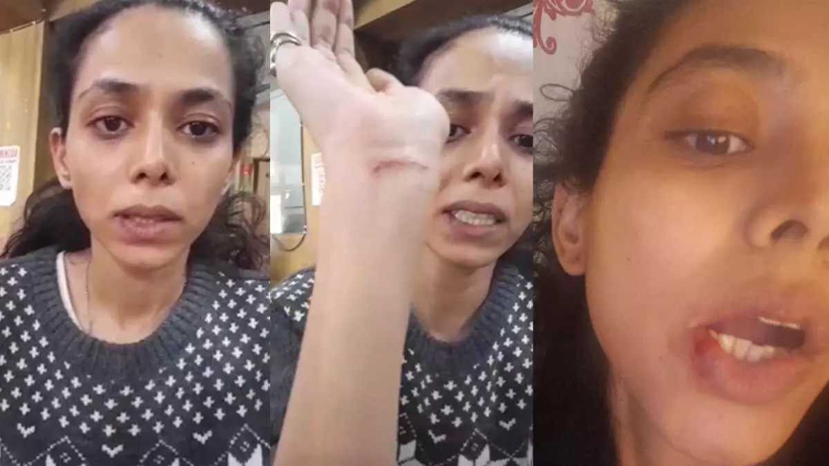 Vaishnavi Dhanraj : గాయాలతో సీఐడీ ఆర్టిస్ట్.. అసలేమైందంటే.. Vaishnavi Dhanraj : గాయాలతో సీఐడీ ఆర్టిస్ట్.. అసలేమైందంటే..