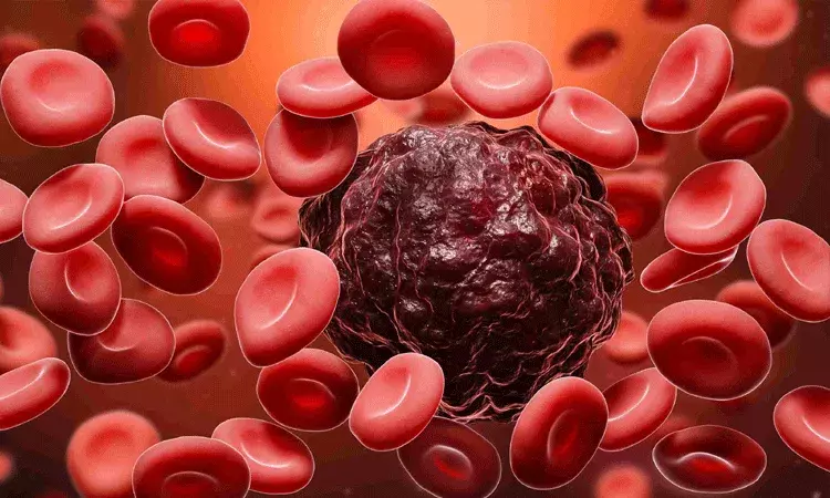 క్యాన్సర్ లక్షణాలు.. విస్మరిస్తున్న స్త్రీ, పురుషులు క్యాన్సర్ లక్షణాలు.. విస్మరిస్తున్న స్త్రీ, పురుషులు