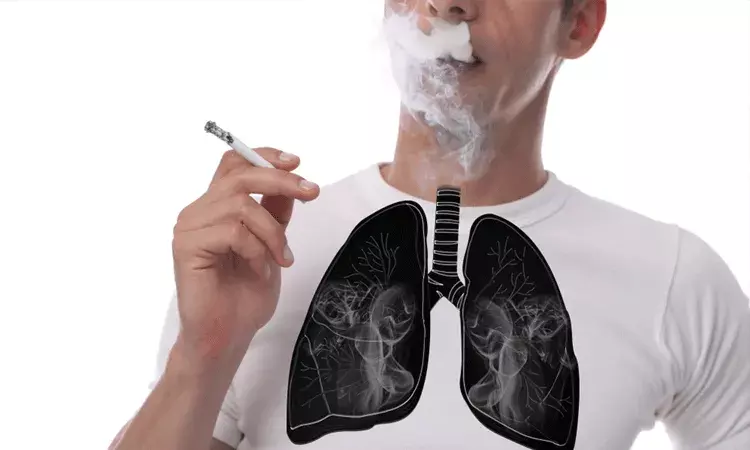 ధూమపానం చేయనివారిలోనూ ఊపిరితిత్తుల క్యాన్సర్.. కారణం ధూమపానం చేయనివారిలోనూ ఊపిరితిత్తుల క్యాన్సర్.. కారణం