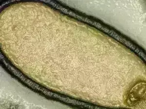 Zombie Virus:  ప్రపంచానికి  ముంచుకొస్తున్న  మరో ముప్పు..