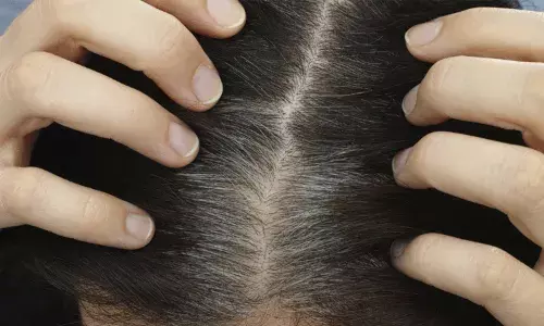 జుట్టు తెల్లబడడానికి కారణం.. తెలియక చేసే ఈ 3 తప్పులు