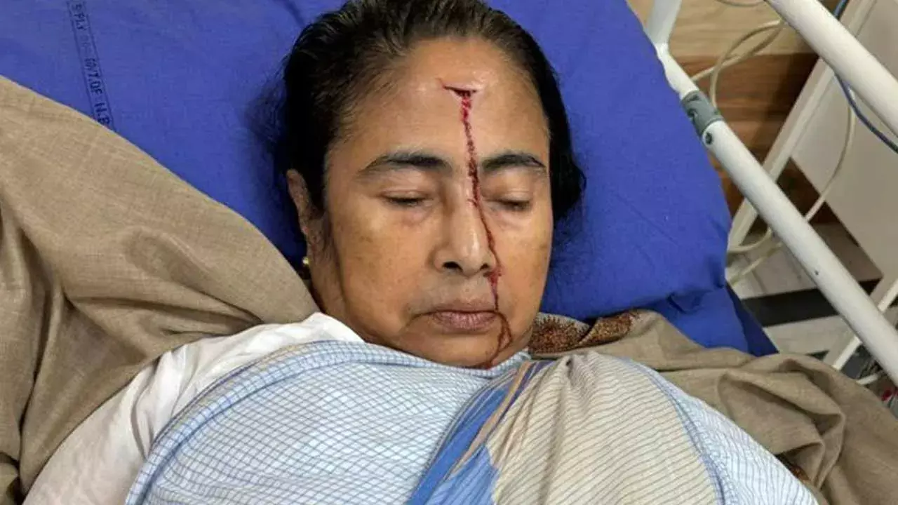 Mmata Benarjee : మమతా బెనర్జీకి గాయం ఎలా అయిందంటే..?