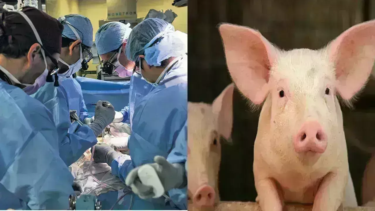 Pig Kidney Transplant: బతికున్న మనిషికి పంది కిడ్నీ .. Pig Kidney Transplant: బతికున్న మనిషికి పంది కిడ్నీ ..