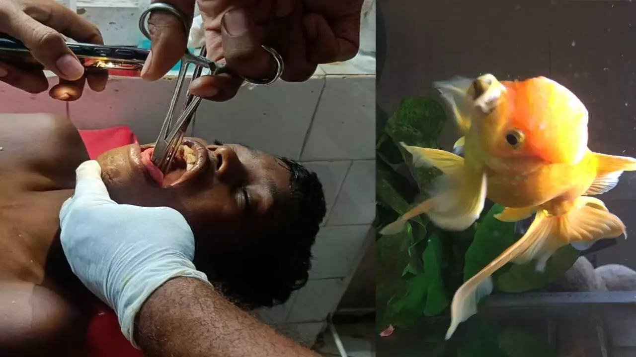 Fish Incident : ఈతకు వెళితే.. గొంతులో చేప ఇరుక్కుపోయింది Fish Incident : ఈతకు వెళితే.. గొంతులో చేప ఇరుక్కుపోయింది