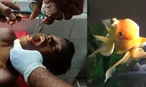 Fish Incident : ఈతకు వెళితే.. గొంతులో చేప ఇరుక్కుపోయింది Fish Incident : ఈతకు వెళితే.. గొంతులో చేప ఇరుక్కుపోయింది