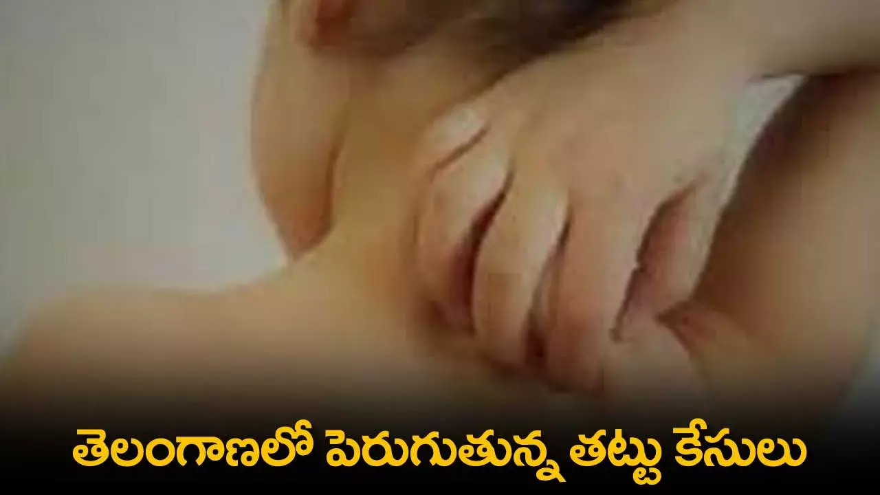 TS : తెలంగాణలో పెరుగుతున్న తట్టు కేసులు TS : తెలంగాణలో పెరుగుతున్న తట్టు కేసులు