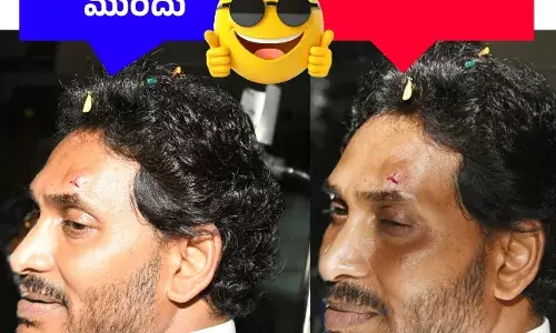 REACTIONS: జగన్‌పై దాడి కోడికత్తి 2.O