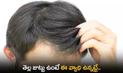 White Hair : తెల్ల జుట్టు ఉంటే ఈ వ్యాధి ఉన్నట్టే.. White Hair : తెల్ల జుట్టు ఉంటే ఈ వ్యాధి ఉన్నట్టే..