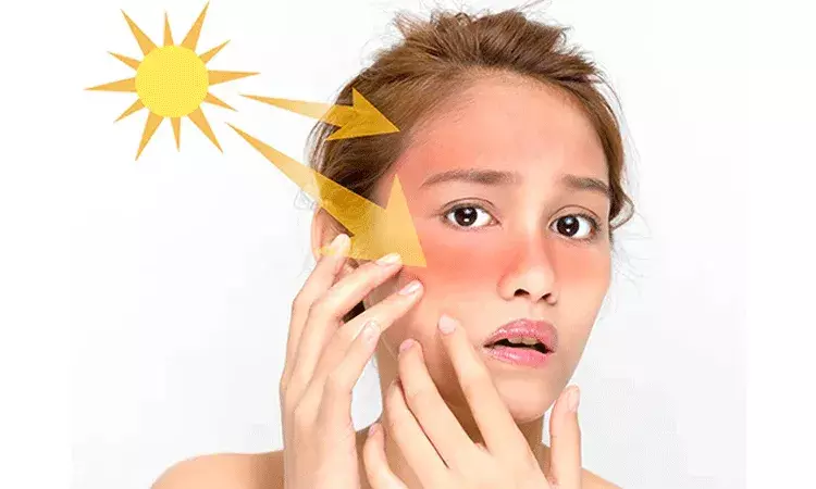 సన్‌స్క్రీన్ అప్లై చేయడం లేదా? .. ప్రమాదకరమైన UV కిరణాలు మీ చర్మాన్ని..