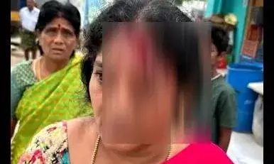 AP: దాడులకు తెగబడుతున్న వైసీపీ శ్రేణులు