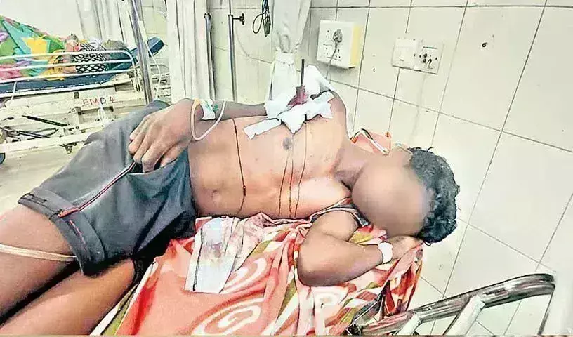 NIIMS: యువకుడి ఛాతిలో బాణం.. ప్రాణాలు కాపాడిన నిమ్స్ వైద్యులు