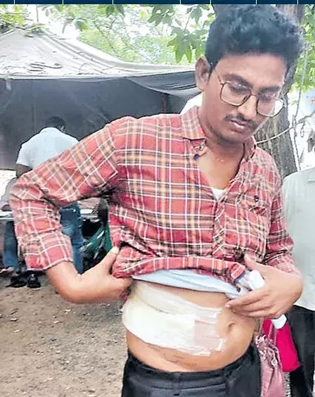 VIJAYAWADA: విజయవాడలో కిడ్నీ దొంగలు VIJAYAWADA: విజయవాడలో కిడ్నీ దొంగలు