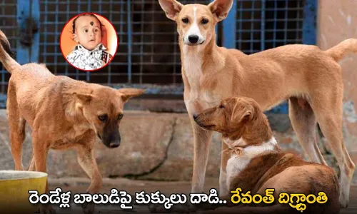 Dogs Attack : రెండేళ్ల బాలుడిపై కుక్కులు దాడి.. రేవంత్ దిగ్భ్రాంతి Dogs Attack : రెండేళ్ల బాలుడిపై కుక్కులు దాడి.. రేవంత్ దిగ్భ్రాంతి