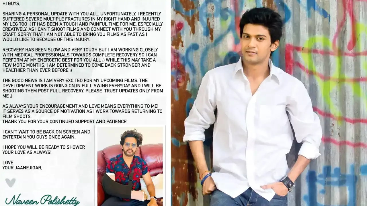 Naveen Polishetty : నవీన్ పోలిశెట్టికి యాక్సిడెంట్ ఎలా జరిగింది..? Naveen Polishetty : నవీన్ పోలిశెట్టికి యాక్సిడెంట్ ఎలా జరిగింది..?