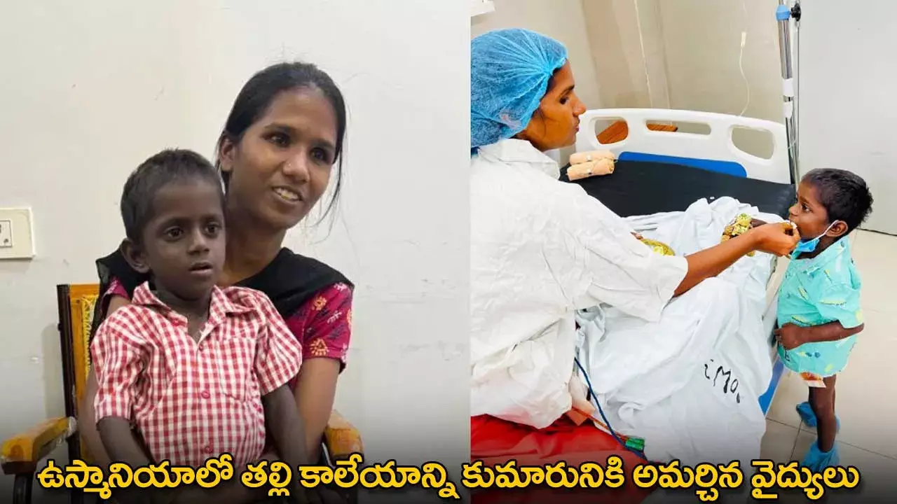 Save Life of Son : ఉస్మానియాలో త‌ల్లి కాలేయాన్ని కుమారునికి అమ‌ర్చిన వైద్యులు