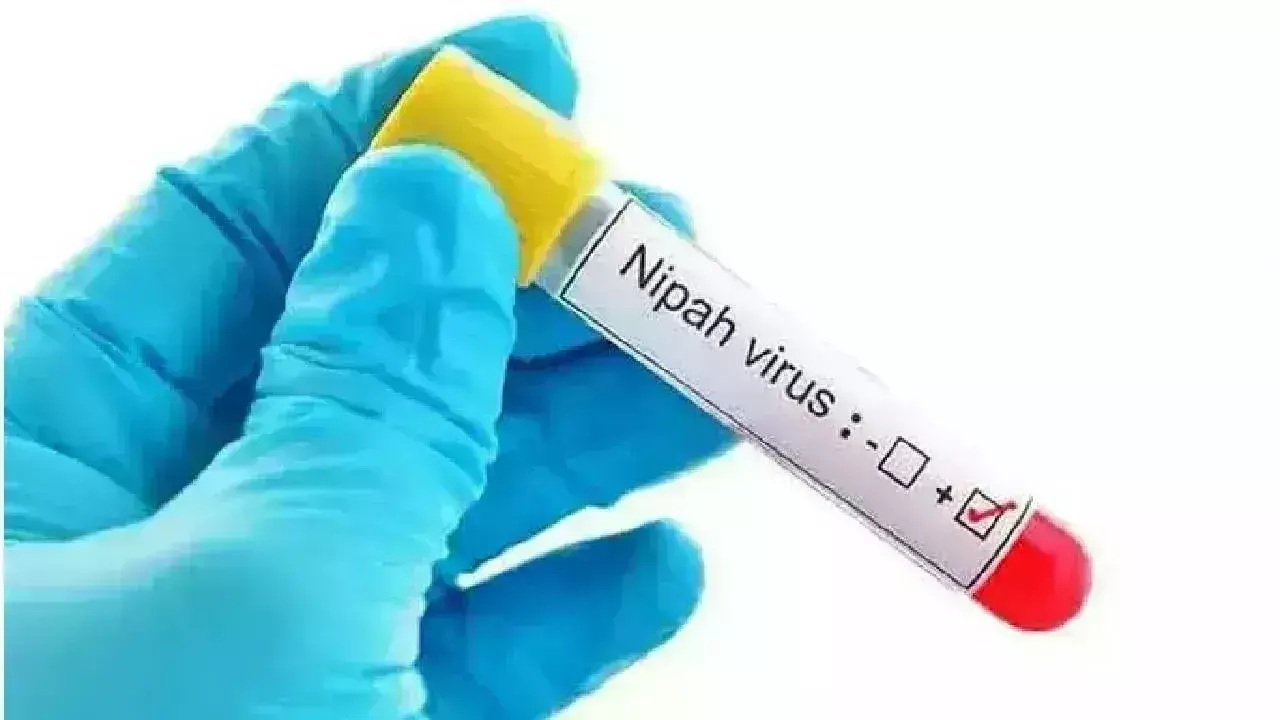 Nipah Virus: కేరళలో నిపా ..14 ఏళ్ల బాలుడికి పాజిటివ్.. Nipah Virus: కేరళలో నిపా ..14 ఏళ్ల బాలుడికి పాజిటివ్..