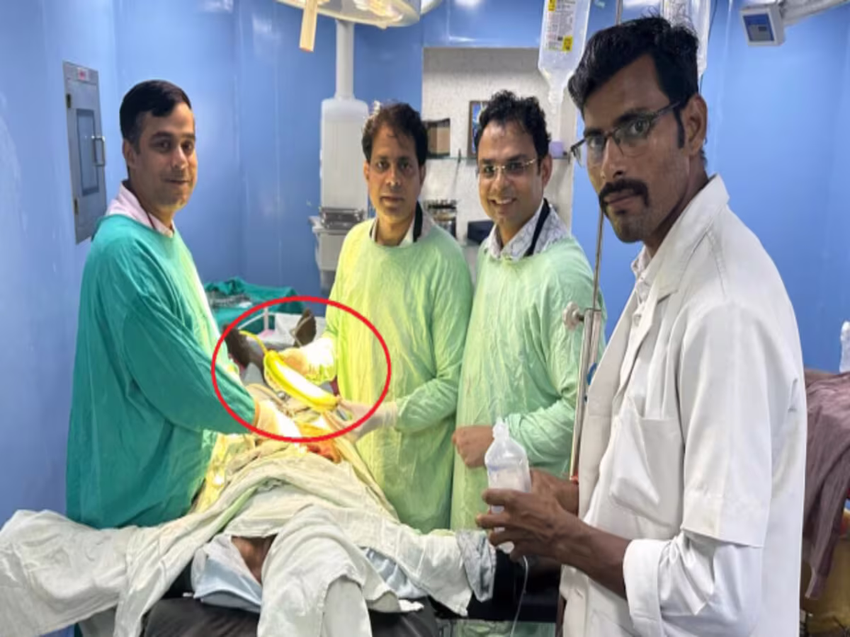 Bottle Gourd-Boy: కడుపు నొప్పితో ఆసుపత్రికి వెళ్లిన యువకుడు.. ఎక్స్రే తీసి చూడగా Bottle Gourd-Boy: కడుపు నొప్పితో ఆసుపత్రికి వెళ్లిన యువకుడు.. ఎక్స్రే తీసి చూడగా