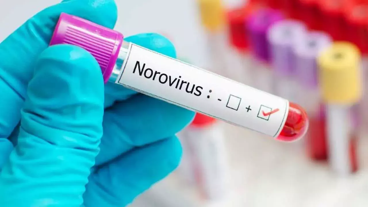 Norovirus : హైదరాబాద్ లో నోరో వైరస్ కలకలం.. లక్షణాలు ఇవే.. Norovirus : హైదరాబాద్ లో నోరో వైరస్ కలకలం.. లక్షణాలు ఇవే..