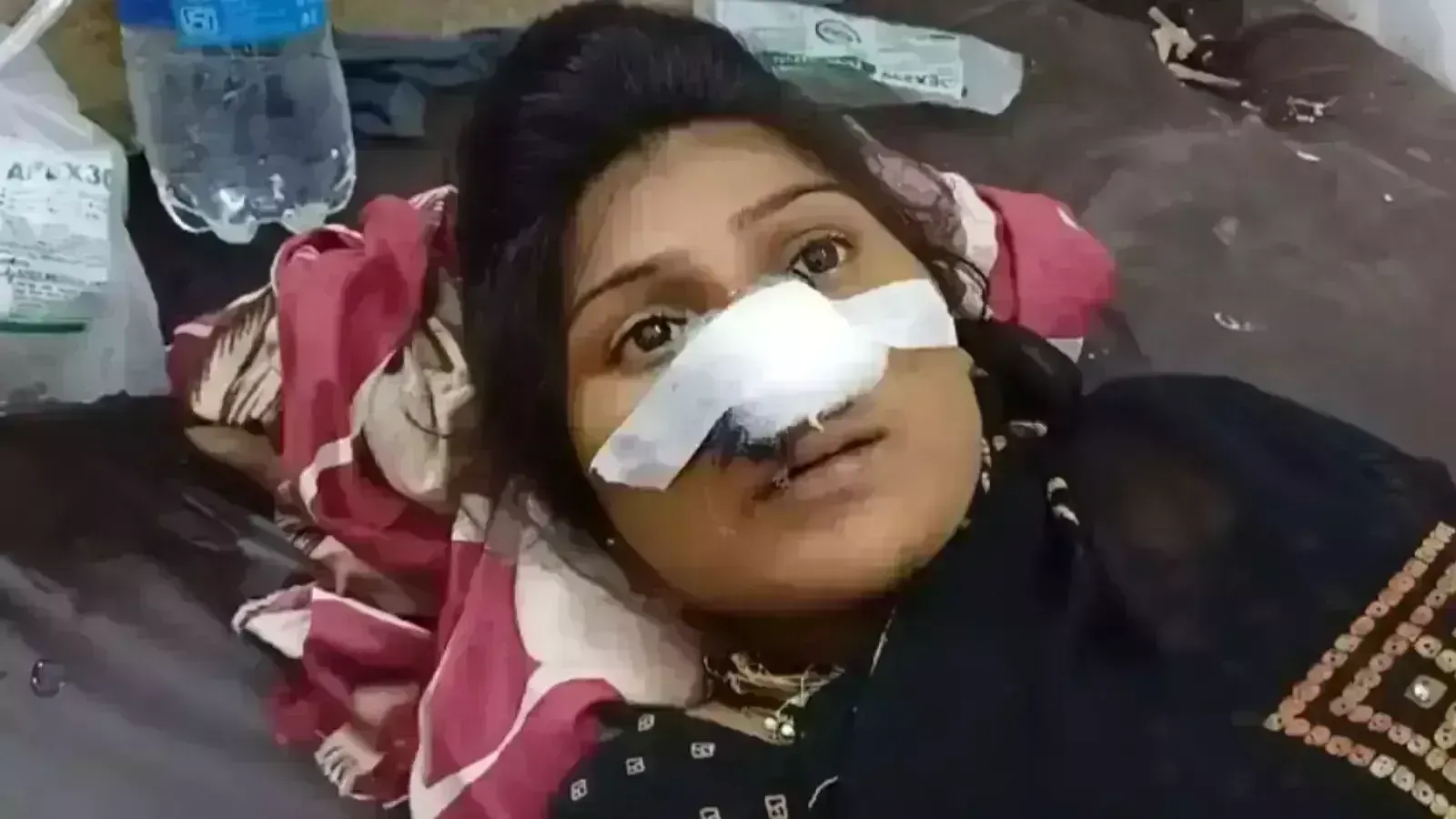 UP News: కోపంతో భార్య ముక్కు కోసేసిన భర్త.. UP News: కోపంతో భార్య ముక్కు కోసేసిన భర్త..