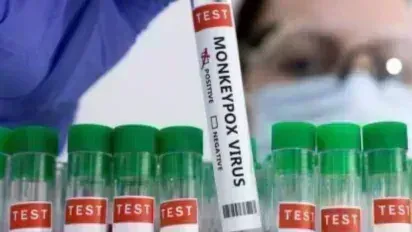MPOX: భారత్ లోకి మంకీపాక్స్ ఎంట్రీ MPOX: భారత్ లోకి మంకీపాక్స్ ఎంట్రీ