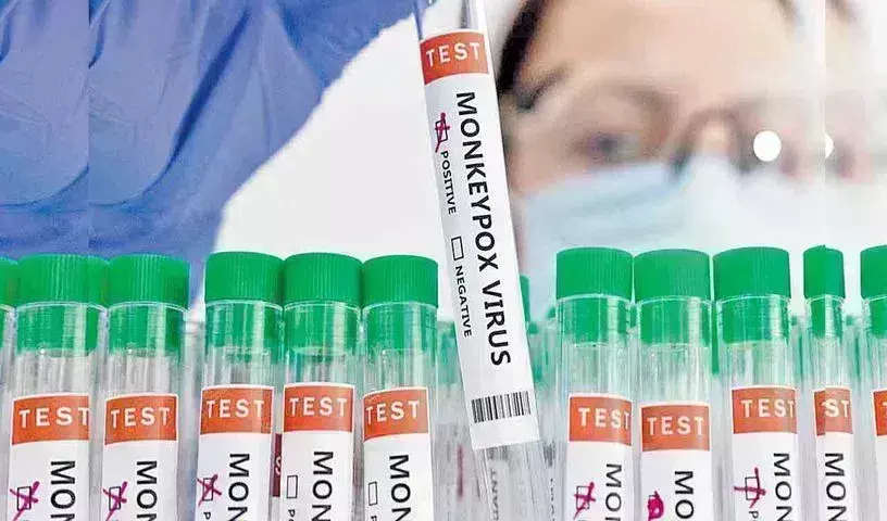 Monkeypox: దేశంలో మంకీపాక్స్ నిర్ధారణ..కేంద్ర ప్రభుత్వం కీలక ప్రకటన Monkeypox: దేశంలో మంకీపాక్స్ నిర్ధారణ..కేంద్ర ప్రభుత్వం కీలక ప్రకటన