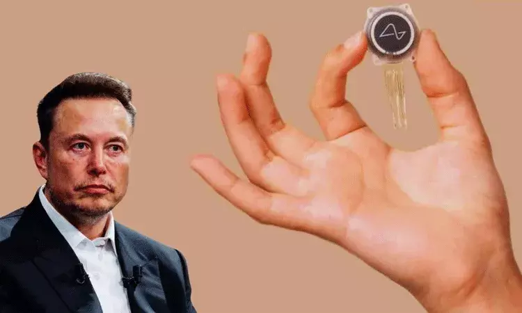 న్యూరాలింక్ తో అంధులకు చూపు: ఎలోన్ మస్క్ ట్వీట్