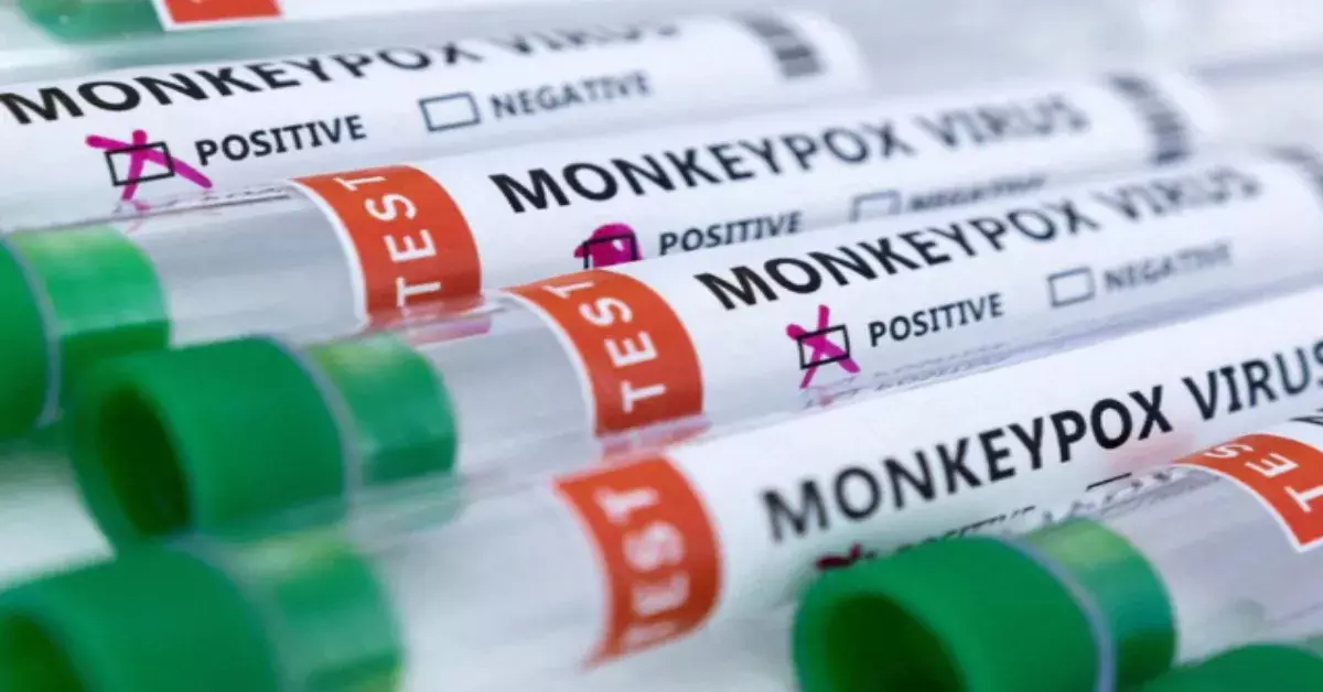 Mpox Case: మంకీ పాక్స్ కలకలం.. భారత్‌లో రెండో కేసు నమోదు