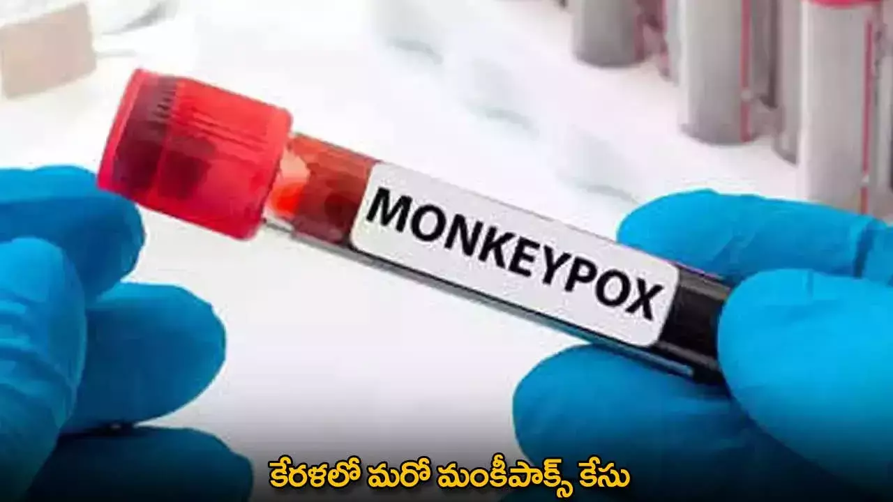 Monkeypox : కేరళలో మరో మంకీపాక్స్ కేసు
