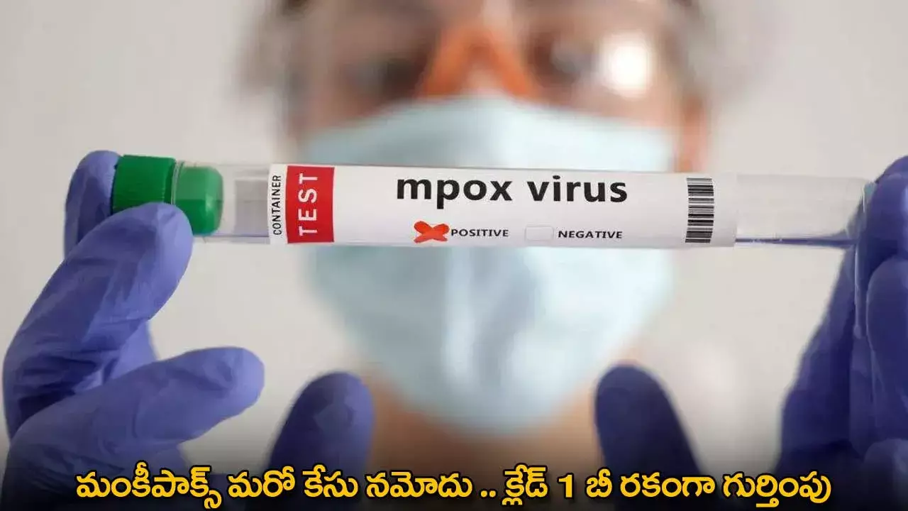Monkeypox : మంకీపాక్స్ మరో కేసు నమోదు .. క్లేడ్ 1 బీ రకంగా గుర్తింపు Monkeypox : మంకీపాక్స్ మరో కేసు నమోదు .. క్లేడ్ 1 బీ రకంగా గుర్తింపు