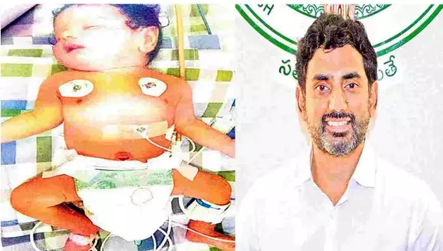 Lokesh: చిన్నారి ప్రాణాలు కాపాడిన నారా లోకేశ్ Lokesh: చిన్నారి ప్రాణాలు కాపాడిన నారా లోకేశ్