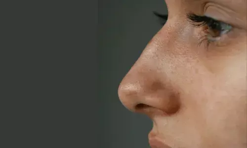 బ్లాక్హెడ్స్ నివారణకు ఇంటి చిట్కాలు ట్రై చేయండి.. బ్లాక్హెడ్స్ నివారణకు ఇంటి చిట్కాలు ట్రై చేయండి..