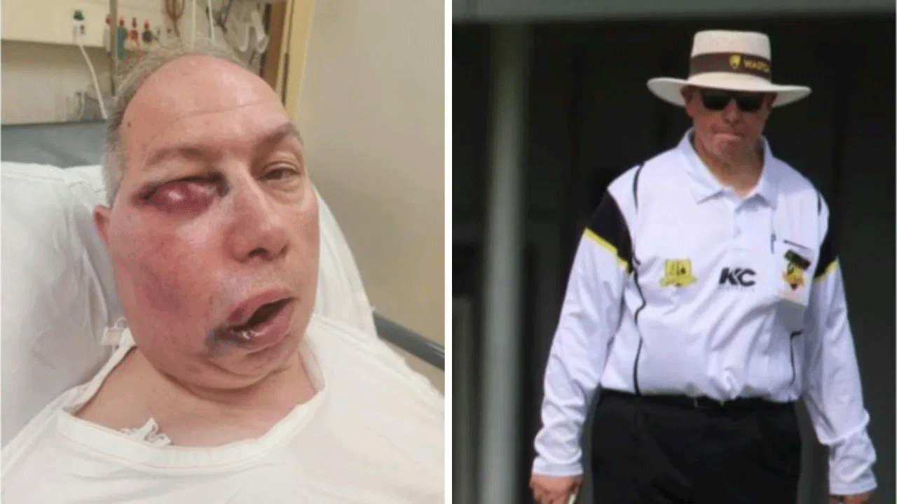 Australian cricket umpire:  అంపైర్ కన్ను, మూతి పగిలిపోయింది