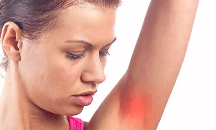 చంకల్లో దురద బ్రెస్ట్ క్యాన్సర్ సంకేతమా.. నిపుణులు ఏం చెబుతున్నారు..