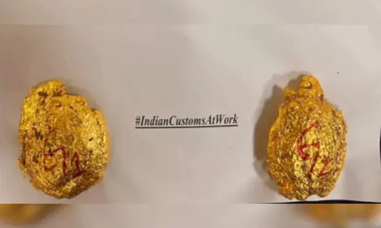 1.7 కిలోల బంగారం స్మగ్లింగ్ చేస్తున్న ప్రయాణీకుడికి సహాయం చేసిన ఎయిర్ ఇండియా క్యాబిన్ క్రూ సభ్యుడు.. అరెస్ట్