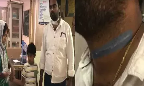 Rangareddy District : షాద్ నగర్లో మాంజా తగిలి భార్య, భర్తలకు తీవ్ర గాయాలు Rangareddy District : షాద్ నగర్లో మాంజా తగిలి భార్య, భర్తలకు తీవ్ర గాయాలు