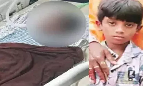 Sri Tej Health Condition : ఇంకా విషమంగానే శ్రీతేజ్ పరిస్థితి