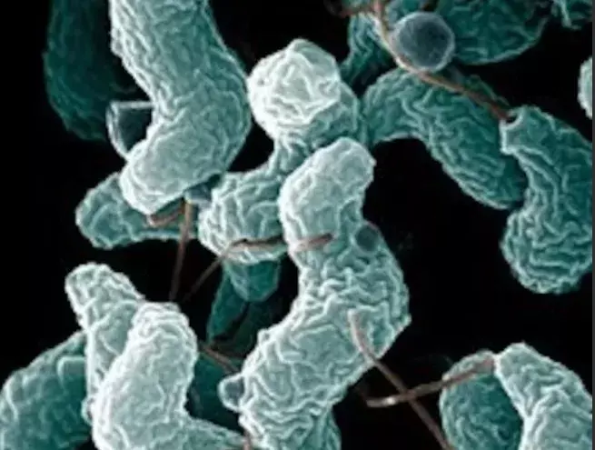 GBS: హైదరాబాద్‌‌కి వచ్చేసిన గులియన్‌ బారే సిండ్రోమ్‌