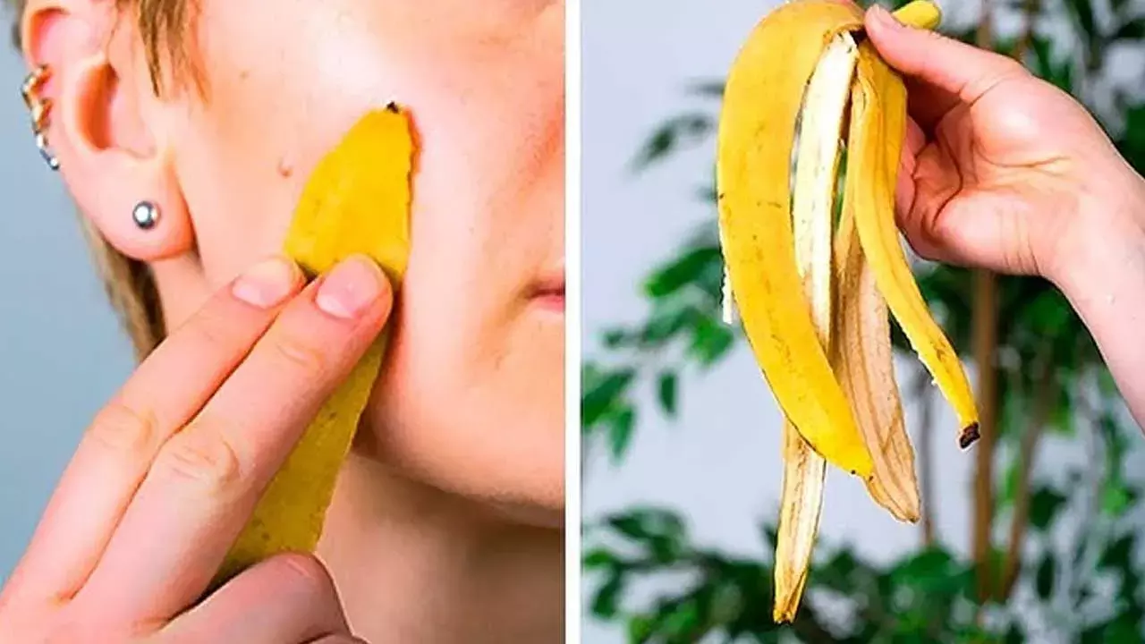 Health Tips : తొక్కే కదా అని తీసి పారేయకండి.. అందానికి మేలు చేసే అరటి తొక్క